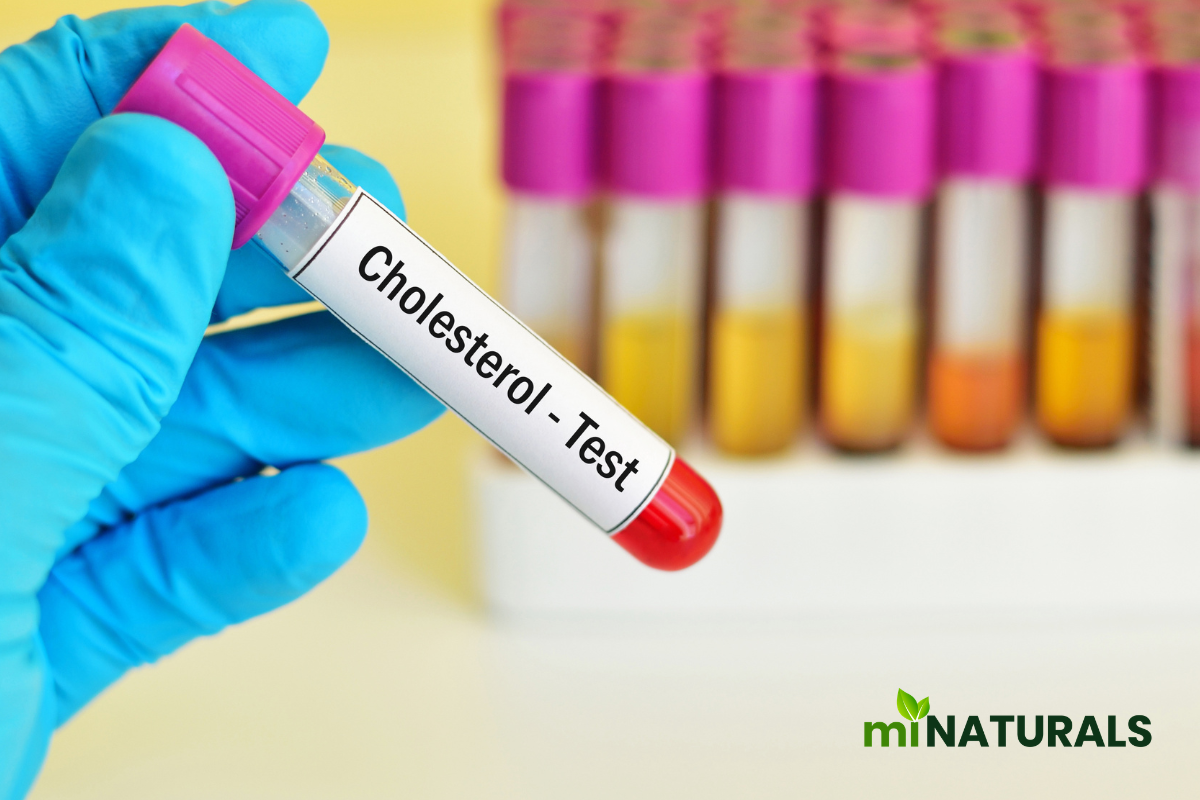 What Is the Best Natural Cholesterol Lowering Supplement in Canada?